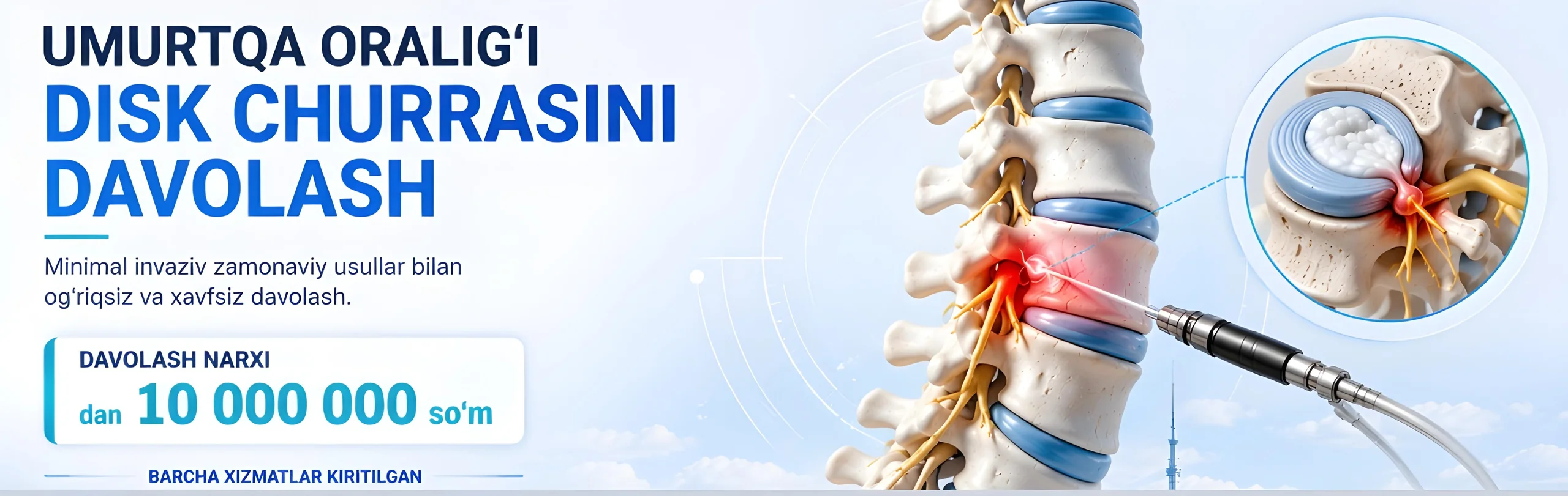 Herniyali disk (neyroxirurgik operatsiya)
