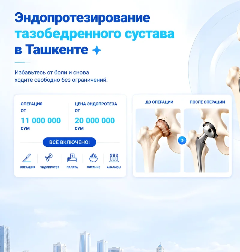 Эндопротезирование тазобедренного сустава