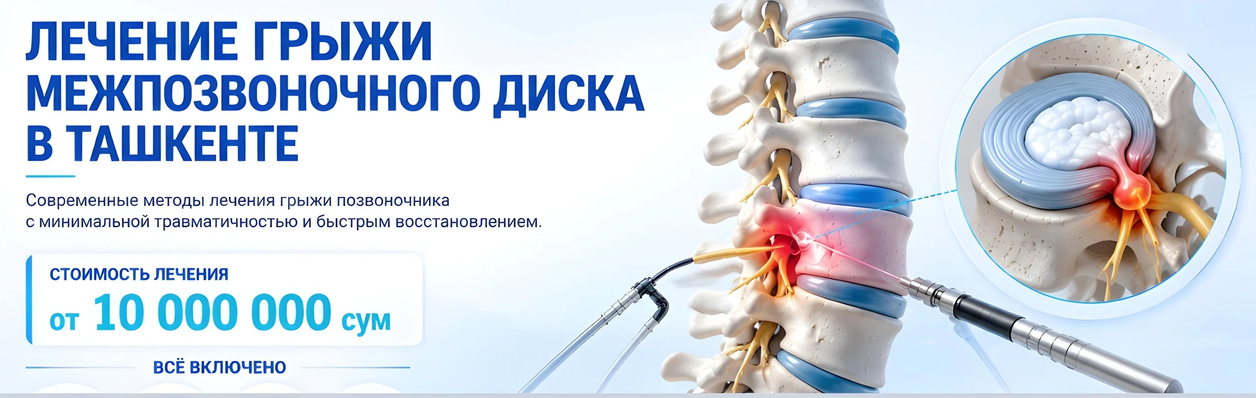 Грыжа межпозвоночного диска (нейрохирургическая операция)