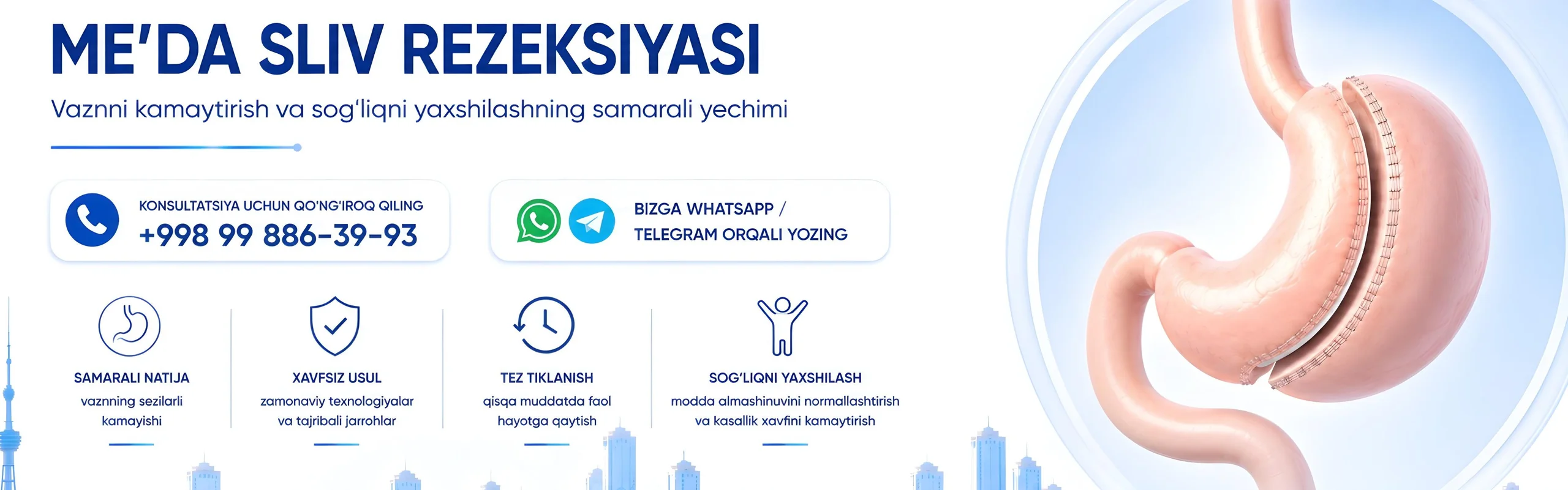 oshqozon rezektsiyasi