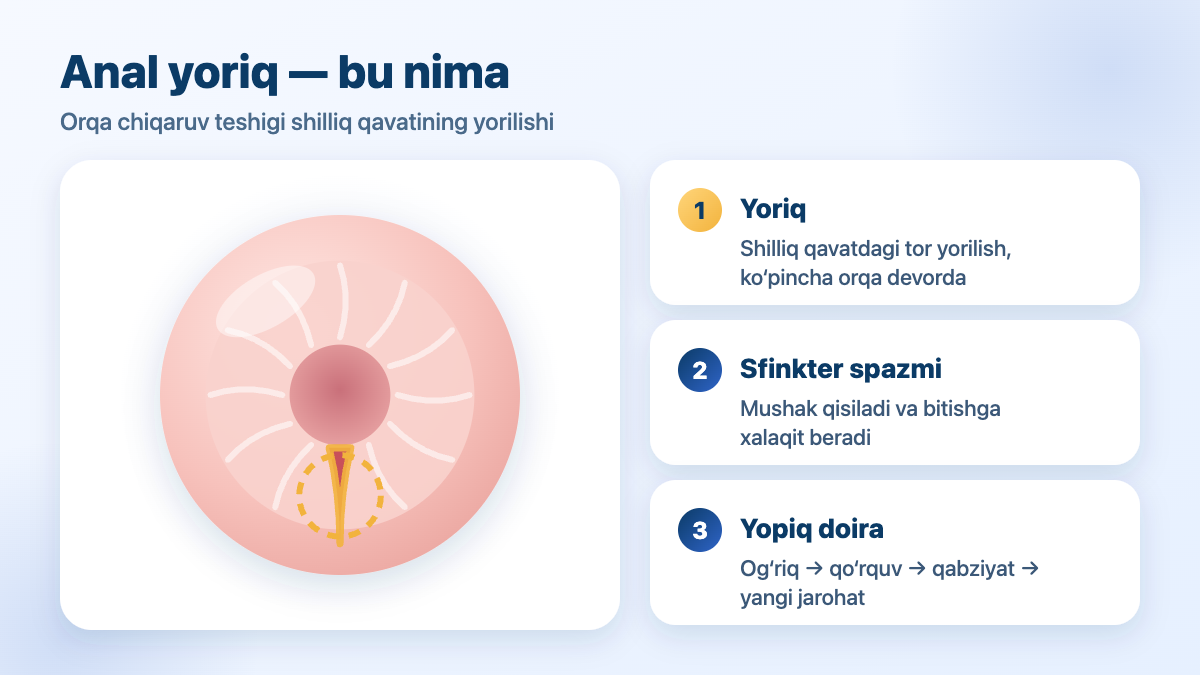 Anal yoriq: orqa chiqaruv teshigi shilliq qavatining yorilishi va sfinkter spazmi — sxema