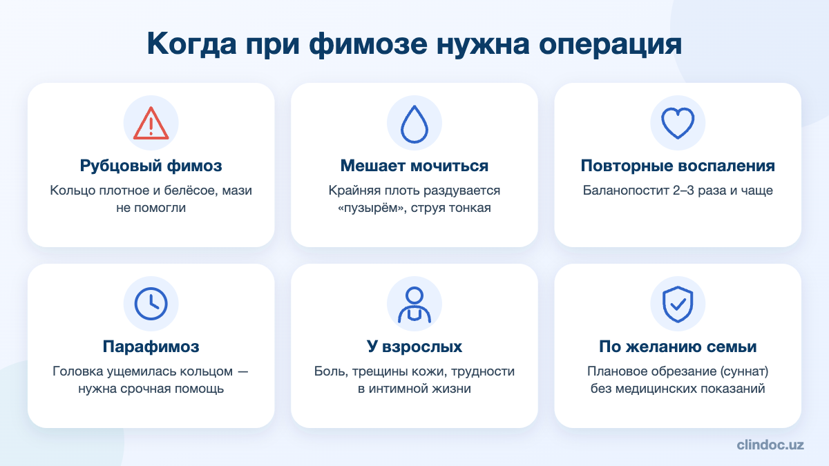 Когда при фимозе нужна операция циркумцизия — показания
