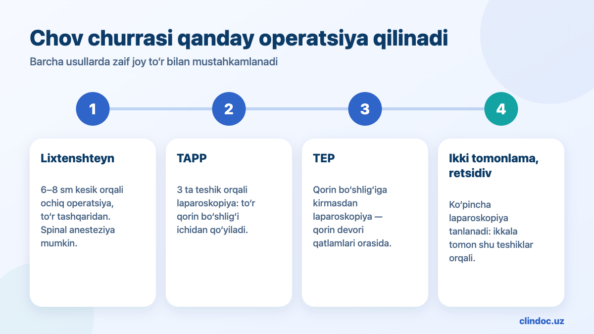 Chov churrasi qanday operatsiya qilinadi: Lixtenshteyn operatsiyasi, laparoskopik gernioplastika TAPP va TEP