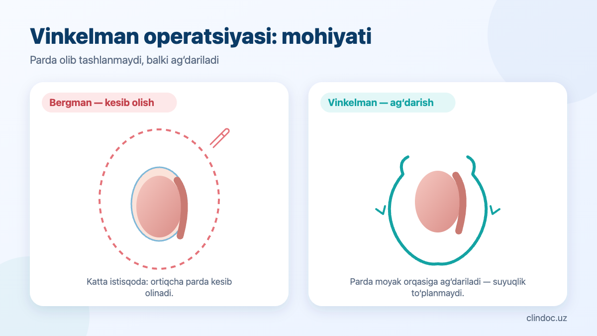 Gidroselda Vinkelman operatsiyasi: moyak pardasini ag‘darish va Bergman operatsiyasi bilan taqqoslash — sxema