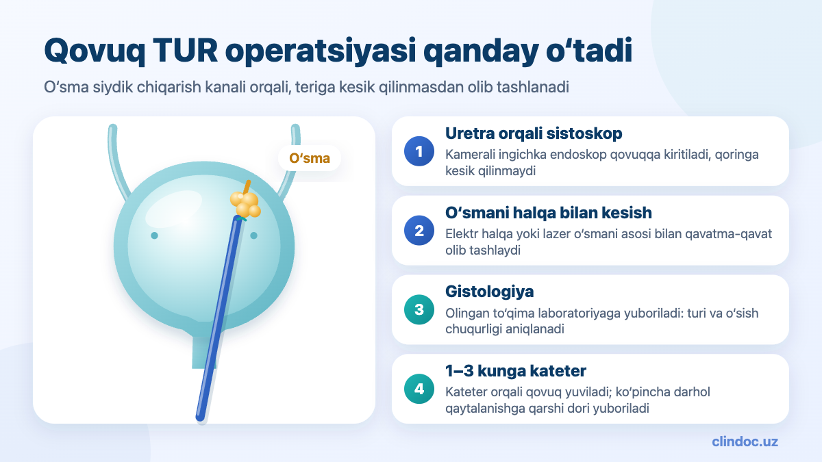 Qovuq o‘smasida TUR operatsiyasi — sxema