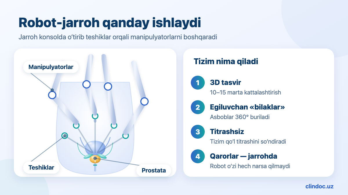Robot-assistirlangan prostatektomiya — robot manipulyatorlari va teshiklar, sxema