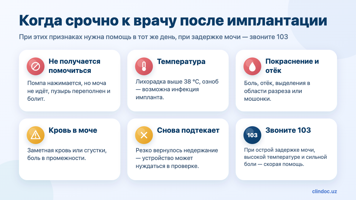 Когда срочно к врачу после имплантации искусственного мочевого сфинктера