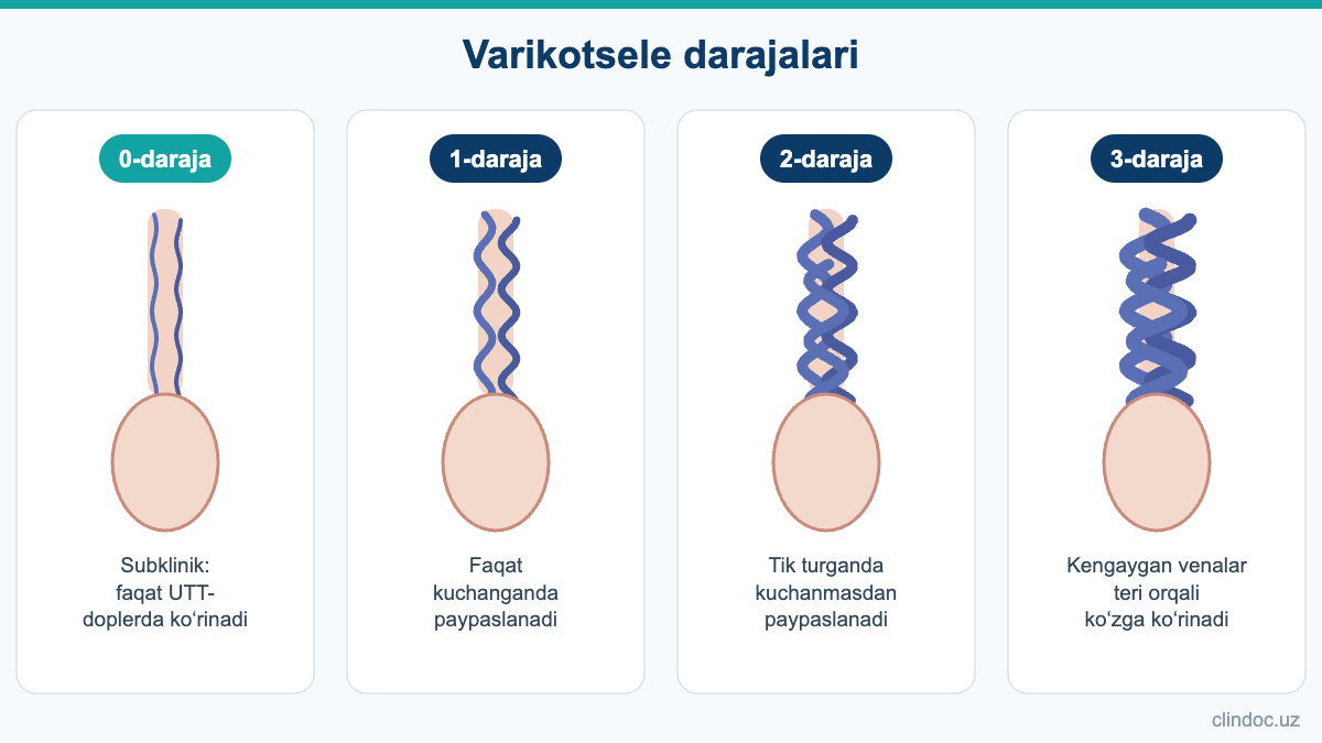 Varikotsele darajalari: subklinikdan 3-darajagacha