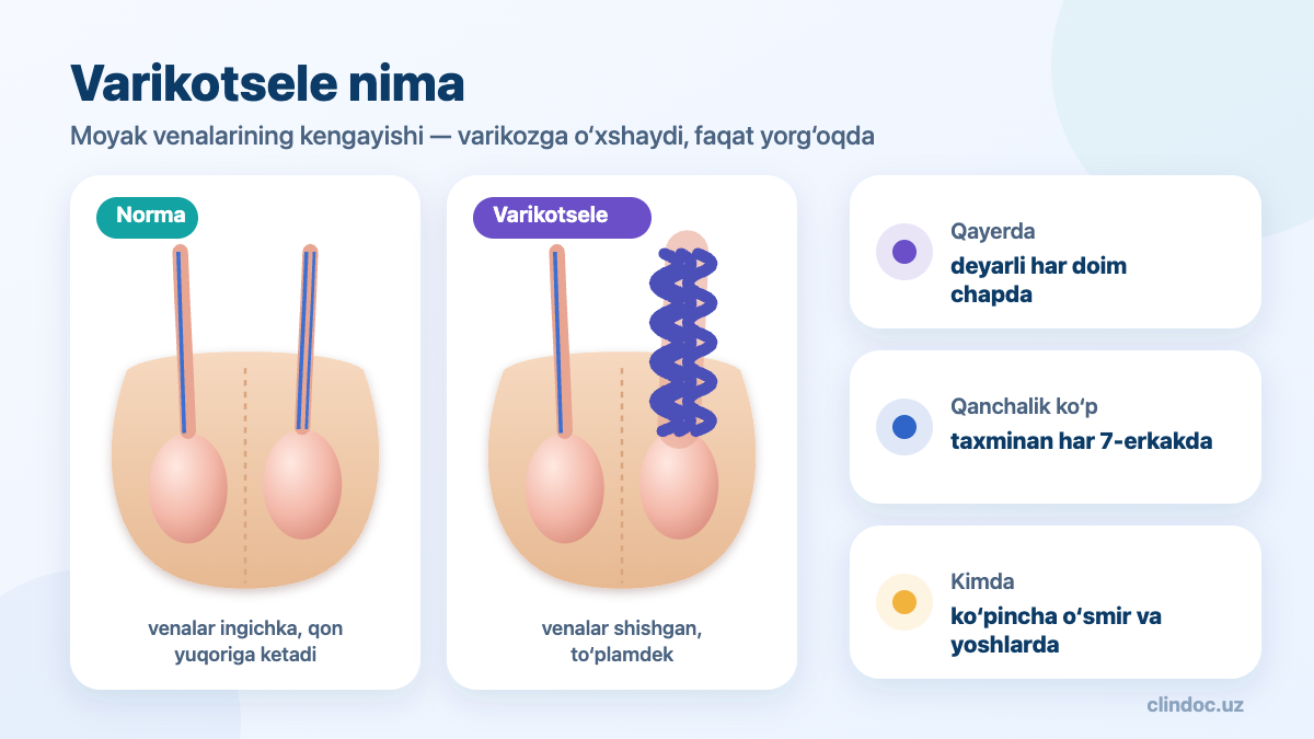Varikotsele nima — norma va moyakning kengaygan venalari