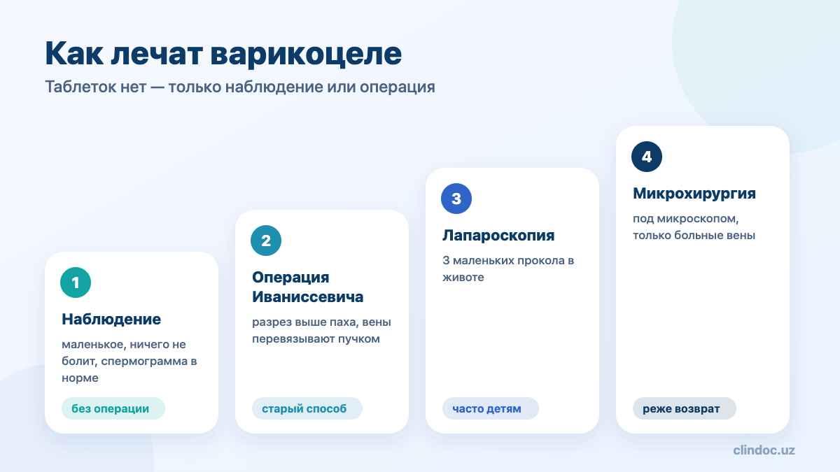 Операции при варикоцеле: Иваниссевич, лапароскопия, микрохирургия