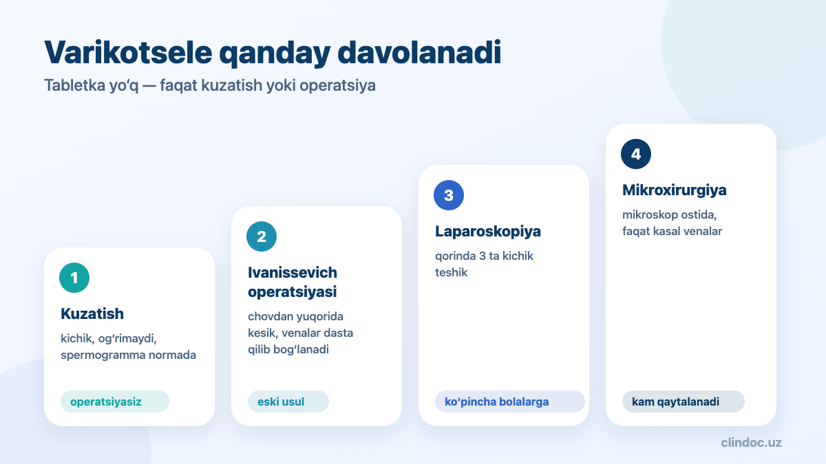 Varikotsele operatsiyalari: Ivanissevich, laparoskopiya, mikroxirurgiya
