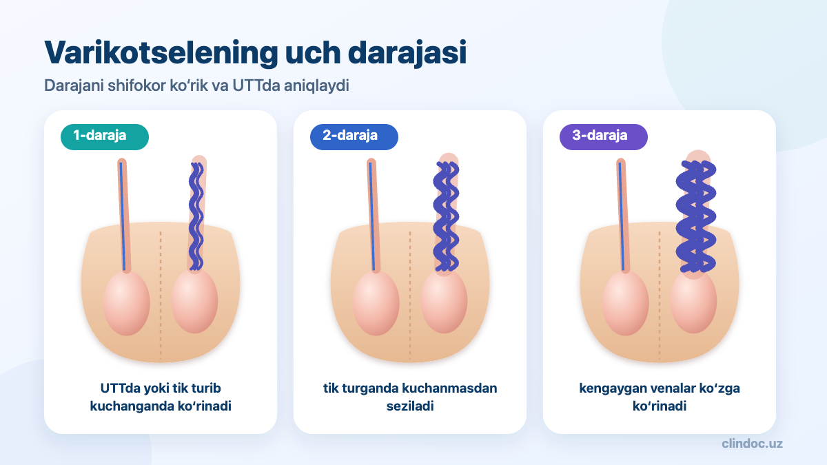 Varikotselening uch darajasi