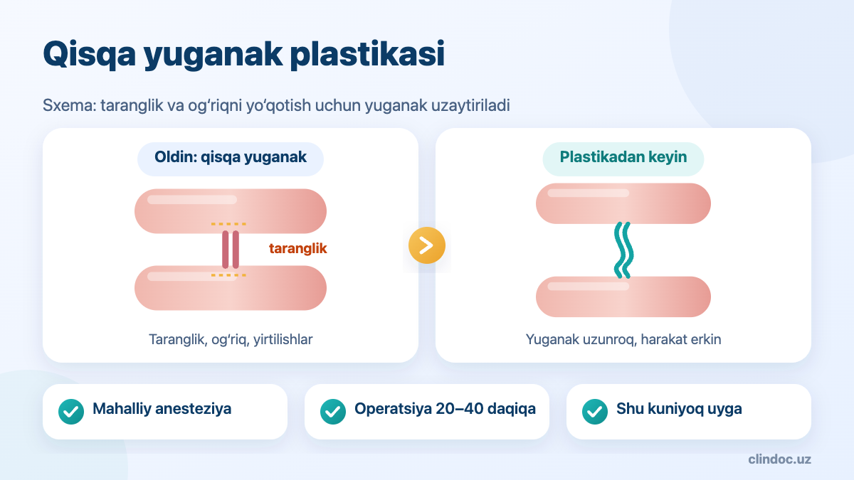 Jinsiy olat qisqa yuganagi plastikasi: frenuloplastikadan oldin va keyin — sxema